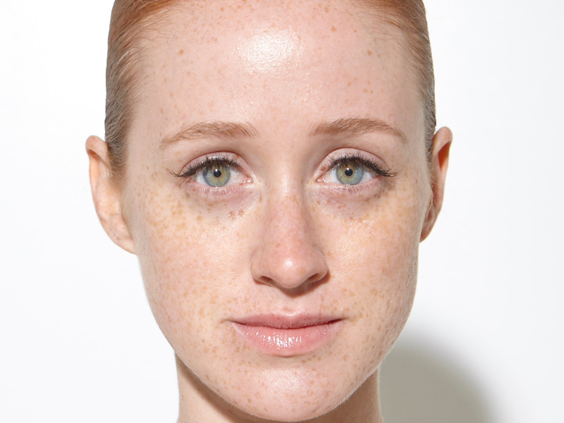 What is Lip Plumper Actually Doing and Why Should Redheads Be Careful?